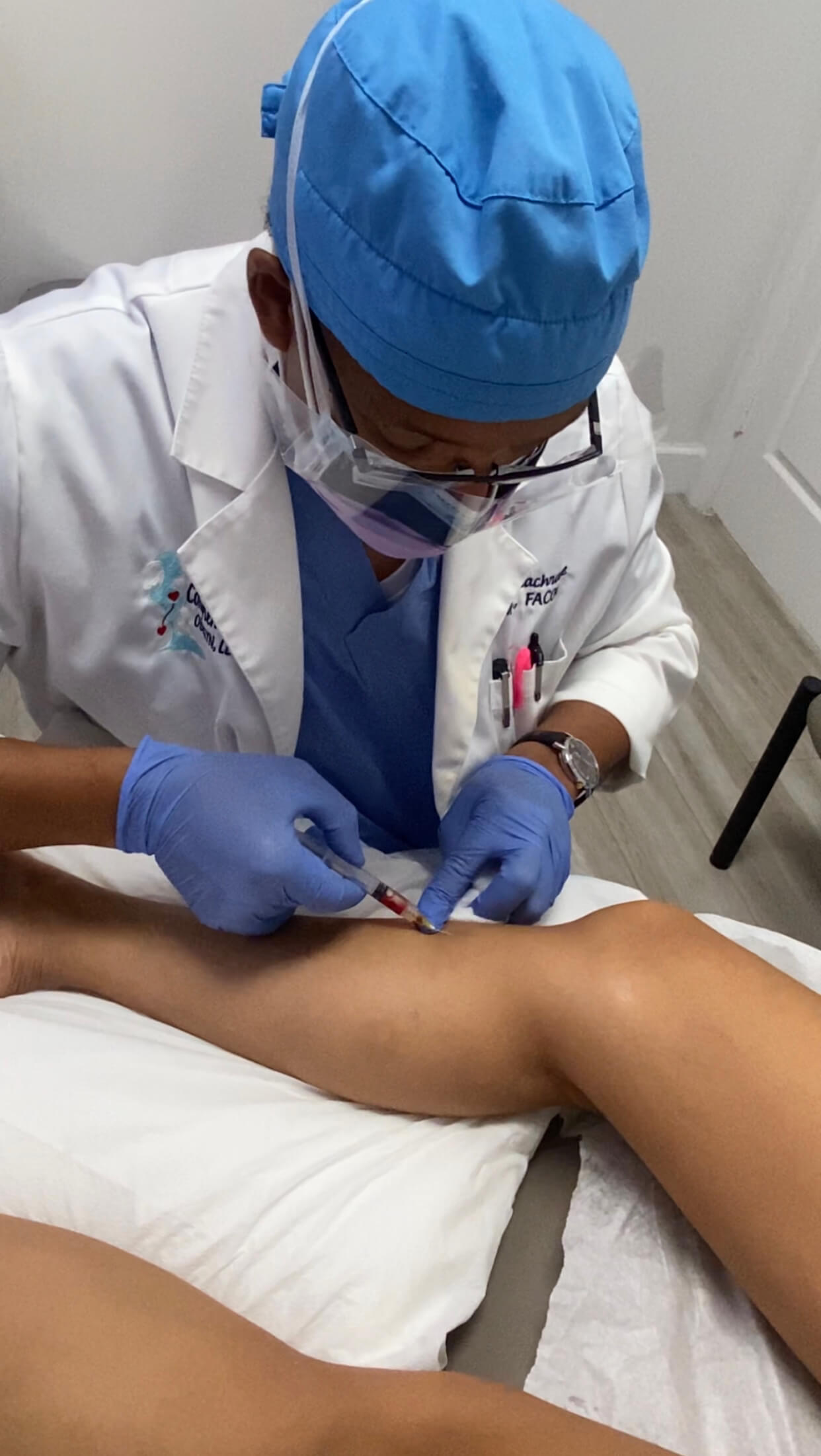 doctor treating spider veins on leg