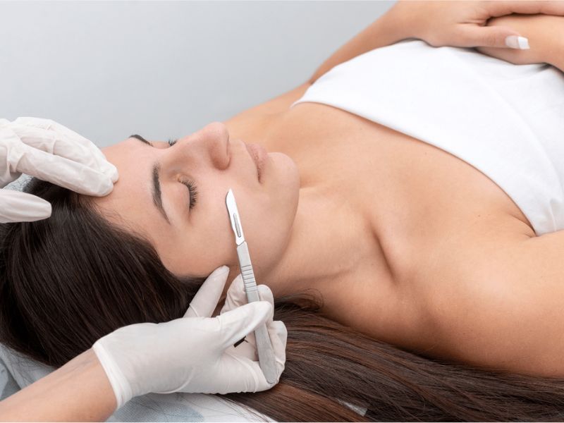 Dermaplaning