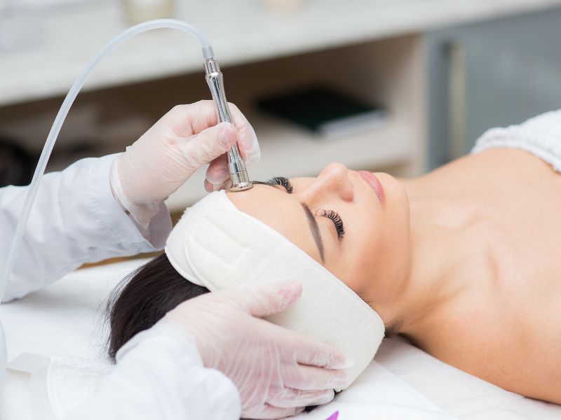 Microdermabrasion