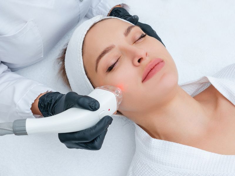 Skin Rejuvenation Laser