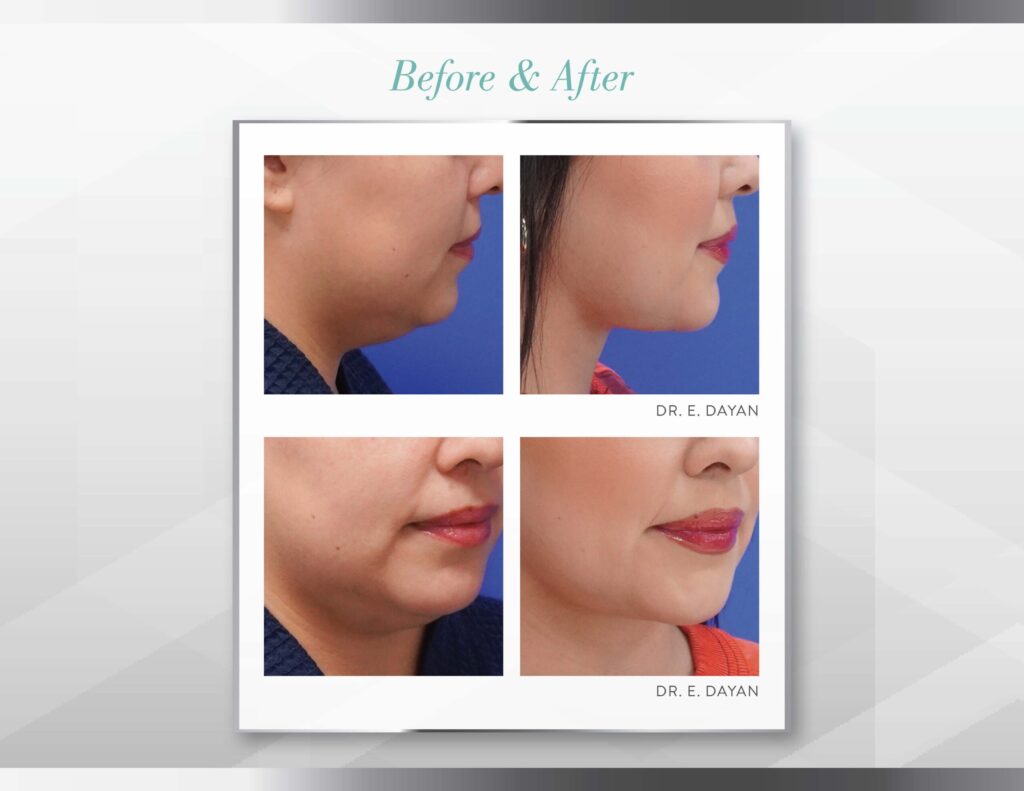 Quantum RF in Coral Springs, FL