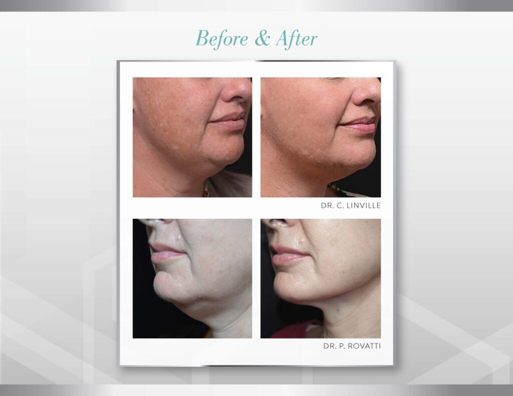 Quantum RF in Coral Springs, FL