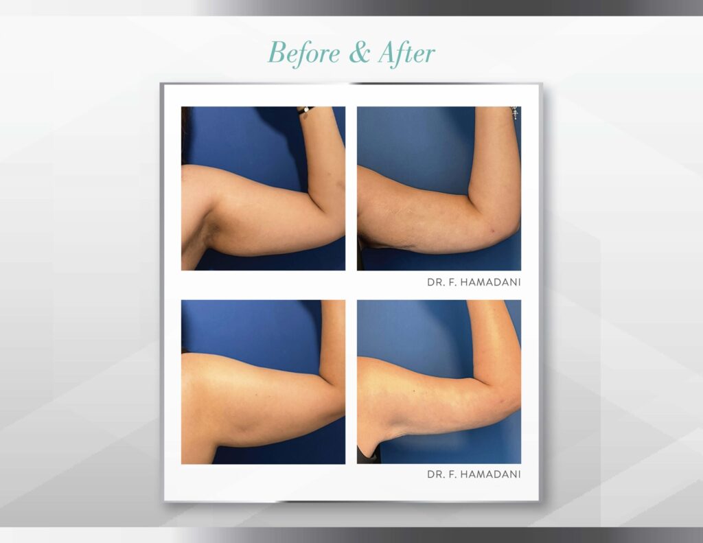 QuantumRF Lookbook 0326 Page 14