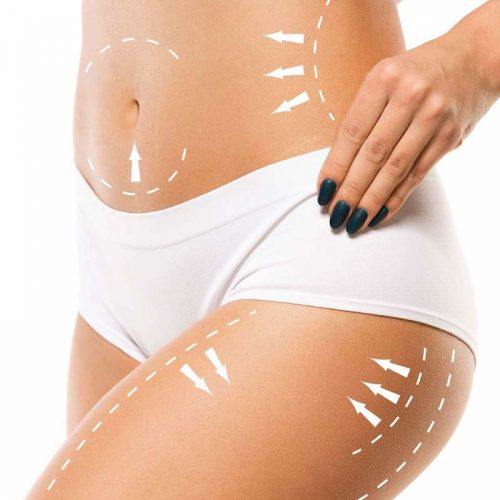 MD Touch Liposuction